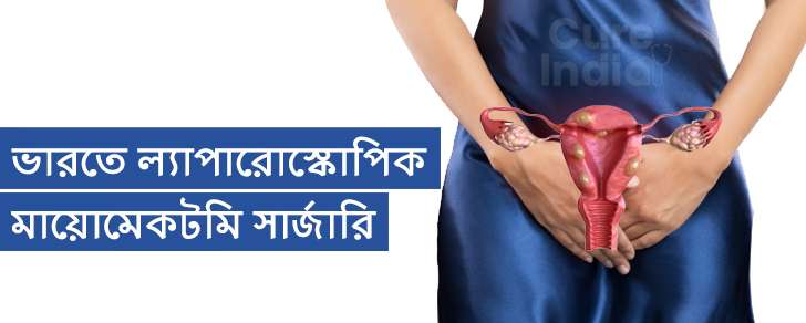 ল্যাপারোস্কোপিক মায়োমেকটমি